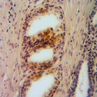 19 - Anti-Arginase 2 Antibody [KO/KD Validated] AP59482