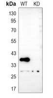 0 - Anti-Arginase 2 Antibody [KO/KD Validated] AP59482