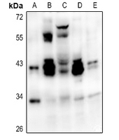1 - Anti-ATF1 Antibody AP59483