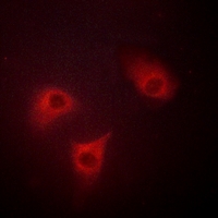 3 - Anti-BAK Antibody AP59484