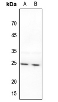 1 - Anti-BAK Antibody AP59484
