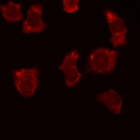 3 - Anti-BCL2 (Phospho-T69) Antibody AP59485