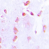 19 - Anti-BCL2 (Phospho-T69) Antibody AP59485