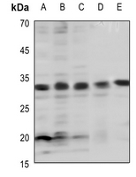1 - Anti-BCL2 (Phospho-T69) Antibody AP59485