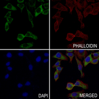 3 - Anti-BMP3 Antibody AP59486