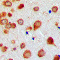 19 - Anti-BMP7 Antibody AP59488