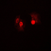 3 - Anti-B-RAF Antibody AP59489