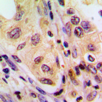 19 - Anti-B-RAF Antibody AP59489