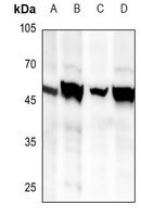 1 - Anti-BRS3 Antibody AP59490