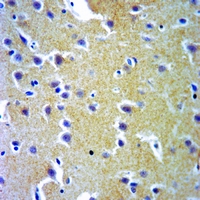 19 - Anti-Probetacellulin Antibody AP59492