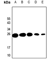 1 - Anti-Probetacellulin Antibody AP59492