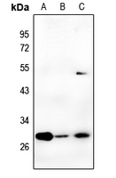1 - Anti-Carbonic Anhydrase 2 Antibody AP59493