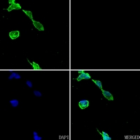 3 - Anti-Carbonic Anhydrase 9 Antibody AP59494