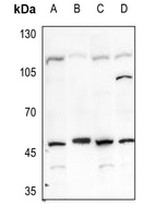 1 - Anti-Carbonic Anhydrase 9 Antibody AP59494