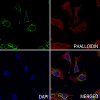 3 - Anti-CD167a Antibody AP59495