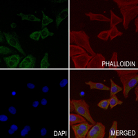 3 - Anti-CaMK2 delta Antibody AP59497
