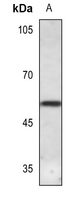 1 - Anti-CaMK2 delta Antibody AP59497
