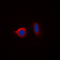 3 - Anti-Calnexin (Phospho-S583) Antibody AP59498