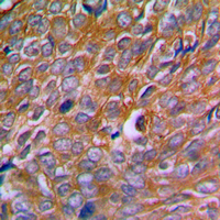 19 - Anti-Calnexin (Phospho-S583) Antibody AP59498