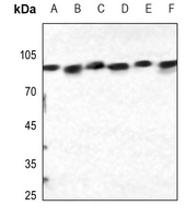 1 - Anti-Calnexin (Phospho-S583) Antibody AP59498