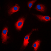 3 - Anti-Caspase 7 Antibody AP59499