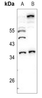 1 - Anti-Caspase 7 Antibody AP59499
