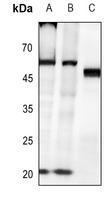 1 - Anti-Caspase 8 (Phospho-Y380) Antibody AP59500