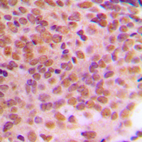 19 - Anti-Cyclin B1 (Phospho-S126) Antibody AP59502