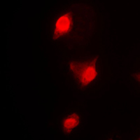 3 - Anti-Cyclin B1 Antibody [KO/KD Validated] AP59503