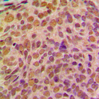 19 - Anti-Cyclin B1 Antibody [KO/KD Validated] AP59503