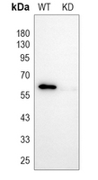 0 - Anti-Cyclin B1 Antibody [KO/KD Validated] AP59503