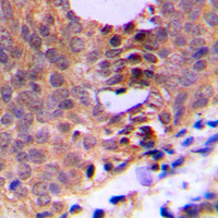 19 - Anti-CDC2 (Phospho-T161) Antibody AP59504