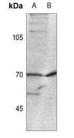 1 - Anti-CDC25A (Phospho-S124) Antibody AP59506