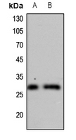 1 - Anti-CDC34 Antibody AP59507