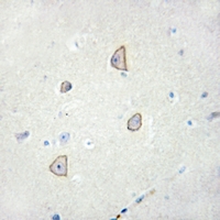 19 - Anti-Cadherin 18 Antibody AP59508