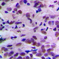 19 - Anti-CDK2 (Phospho-T160) Antibody AP59509