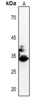 1 - Anti-CDK2 (Phospho-T160) Antibody AP59509