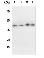 1 - Anti-p27 Kip1 (Phospho-T198) Antibody AP59511