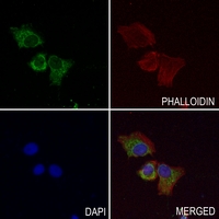 3 - Anti-C/EBP beta Antibody AP59512