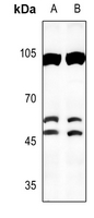 1 - Anti-C/EBP beta Antibody AP59512