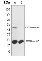 0 - Anti-C/EBP beta Antibody AP59512