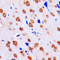 19 - Anti-CHK1 (Phospho-S317) Antibody AP59513