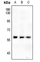 1 - Anti-CHK1 (Phospho-S317) Antibody AP59513
