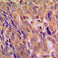 19 - Anti-IKK alpha Antibody AP59514