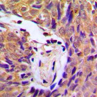 19 - Anti-IKK alpha/beta (Phospho-S180/181) Antibody AP59515