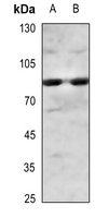 1 - Anti-IKK alpha/beta (Phospho-S180/181) Antibody AP59515