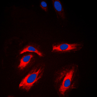 3 - Anti-Creatine Kinase M Antibody AP59516