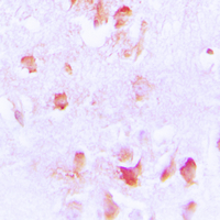 19 - Anti-Creatine Kinase M Antibody AP59516