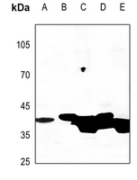 1 - Anti-Creatine Kinase M Antibody AP59516