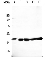 1 - Anti-CLNS1A Antibody AP59518